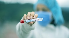 У Србији преминула једна особа, 907 нових случајева коронавируса