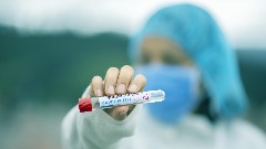 Регистровано 50 нових случајева коронавируса