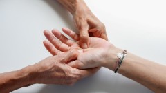 Dermatolog navodi nekoliko navika koje mogu da pogoršaju ekcem thumb1.jpg