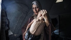 Priča o potresnoj fotografiji majke i njene gladne bebe iz Gaze