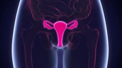 'Nevidljivi invaliditet': Šta je endometrioza i kako se leči na Balkanu