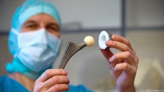 Čekanje na operaciju: Srpski rulet, ulog je život