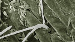 Bioterorizam: Vještačka inteligencija i biotehnologija su novi rizici