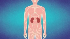 Rak bubrega: Bolest bez simptoma koja brzo napreduje