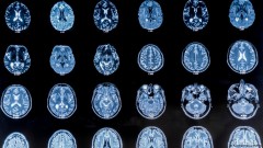 Naš mozak se menja četiri puta