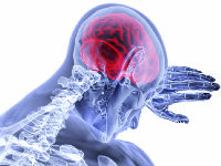 Ženama i muškarcima prijeti bolest mozga