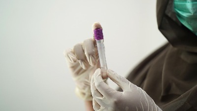 blood-test-56014371280.jpg